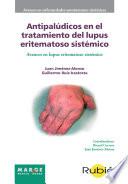 Antipalúdicos En El Tratamiento Del Lupus Eritematoso Sistémico