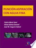 Punción Aspiración Con Aguja Fina