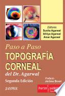 TopografÍa Corneal